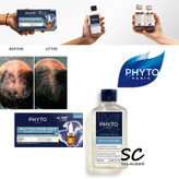 phytocane-men befor after